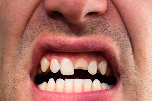 Patient in South End talking to dentist in chair